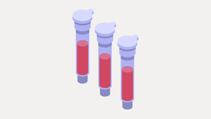 血液の検体輸送