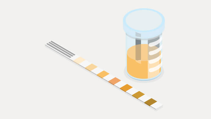 尿・便の検体輸送