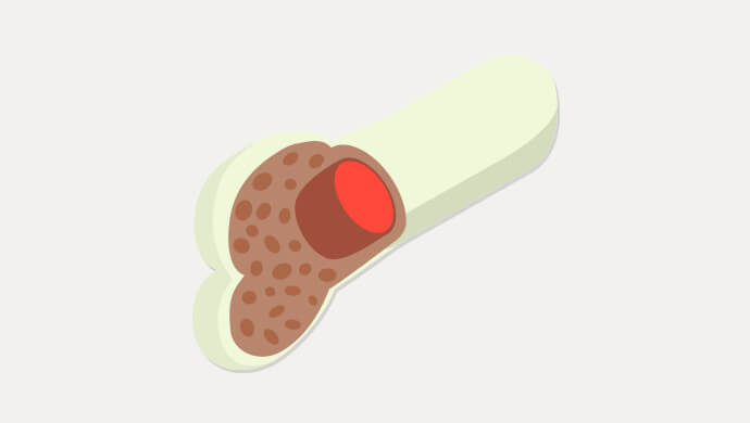 骨髄液の検体輸送